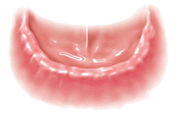 Behandlungsdauer bei Zahnimplantaten